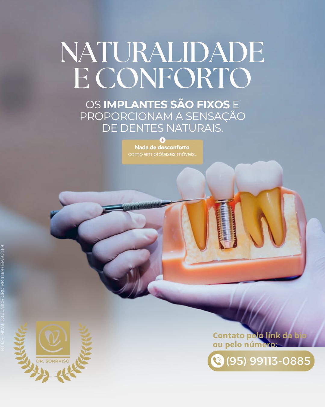 Modelo odontológico demonstrando um implante dentário